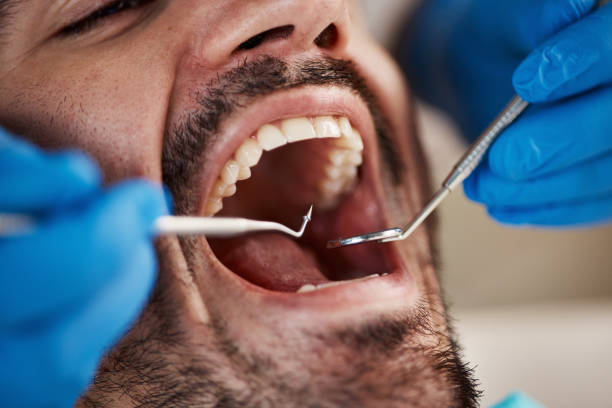 Best Urgent Care for Lost Fillings or Crowns in Burbank, WA